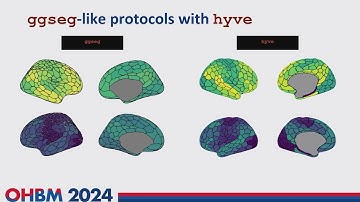 OHBM 2024 | Oral Session | Rastko Ciric |  Hyve, a compositional visualisation engine for neuroima…