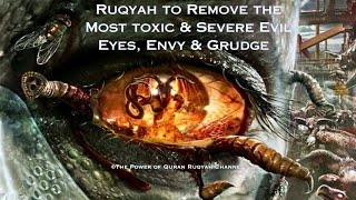 Ultimate Ruqyah to Remove the Most Toxic&Severe Evil Eyes,Envy&Grudge Effecting all Aspects of life