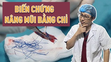 Bác sĩ tiết lộ tại sao không nên nâng mũi bằng chỉ? | Bs Mạnh