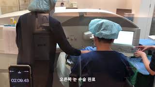 소요시간 겨우 4분?! 압구정안과 스마일라식 김준현 원장 타임어택 ! 3편