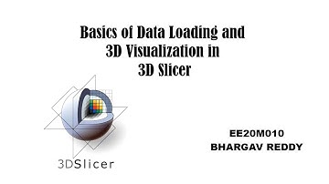 3d slicer ASSIGNMENT