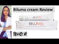 Biluma Review Hindi | Skin lightening cream | काले दाग कम  करने का क्रीम | त्वचा के डॉक्टर