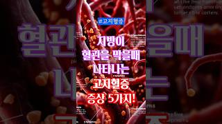 지방이 혈관을 막을때 나타나는 고지혈증 증상5가지 #건강이슈 #고지혈증증상 #혈관건강