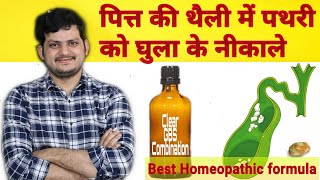 Clear GBS Combination for gall bladder stone ? Remove permanent Gall bladder stone |