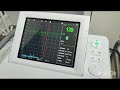 КТГ плода в клинике CMD Домодедово парк КТГ плода в клинике CMD Домодедово парк