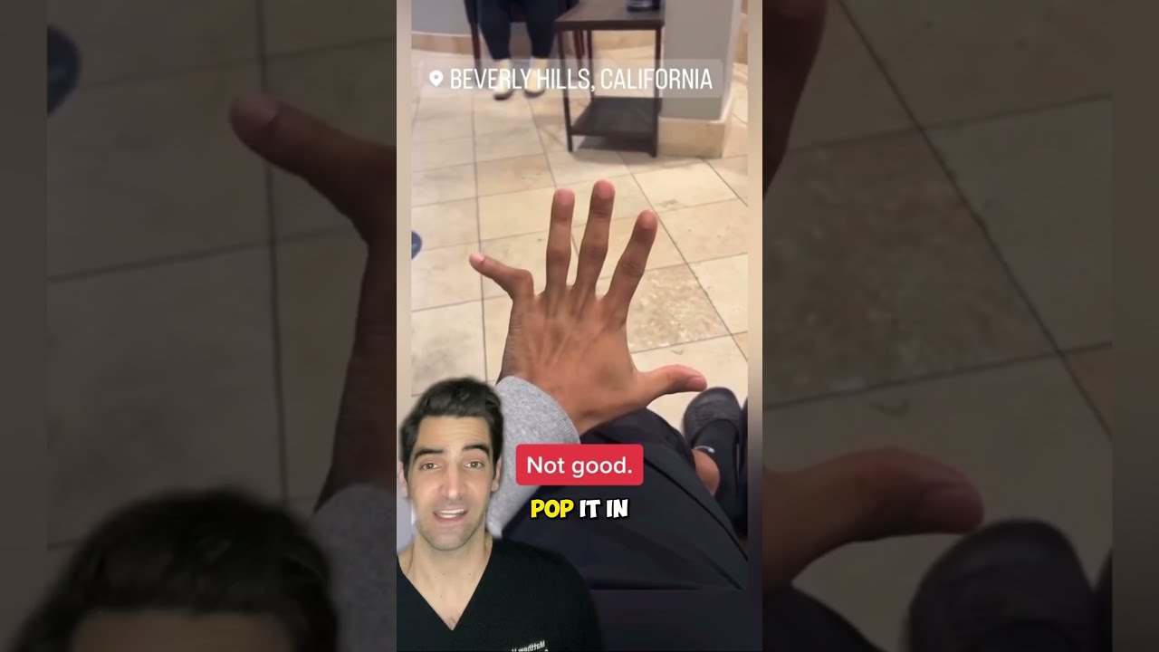 Finger Dislocation