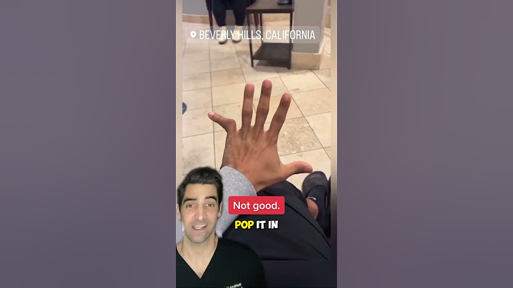 Finger Dislocation