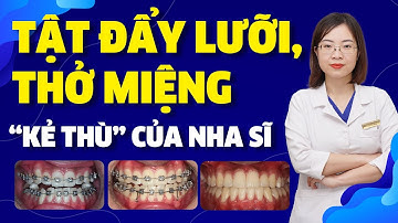 Niềng Răng Có Tật Đẩy Lưỡi, Thở Miệng "Kẻ Thù" Của Nha Sĩ | Case Lâm Sàng Phần 3 | Nam Bùi Vinalign