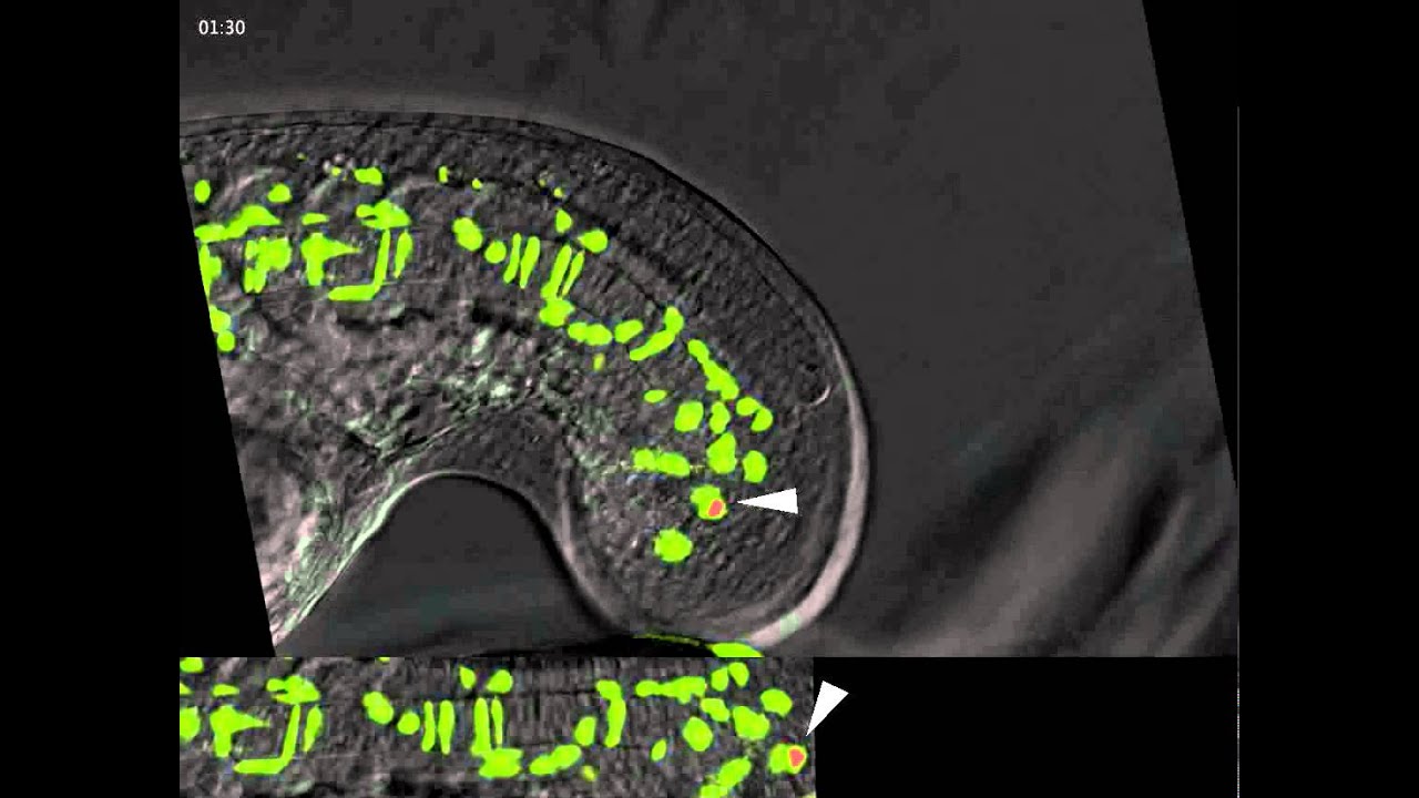 Zebrafish tailbud development - YouTube