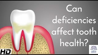 Can Deficiencies Affect Tooth Health