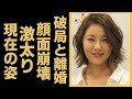 瀬戸朝香が井ノ原快彦と破局した理由や2度の事故の真相に驚きを隠せない...!『イノッチ』の妻として知られる名女優の豪邸や年収...多重整形の現在に一同驚愕...!