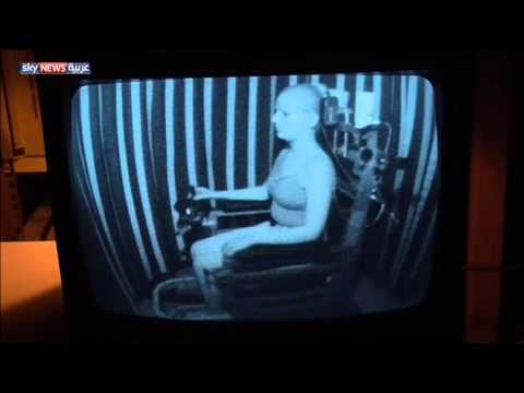 تجربة لعلاج للدوار المزمن بالرقص