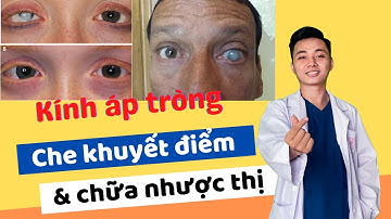 Kính áp tròng thẩm mỹ khắc phục sẹo giác mạc và bịt mắt điều trị nhược thị | OptomDang Official