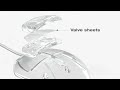 Ahmed Glaucoma Valve Surgical Animation Ahmed Glaucoma Valve Surgical Animation
