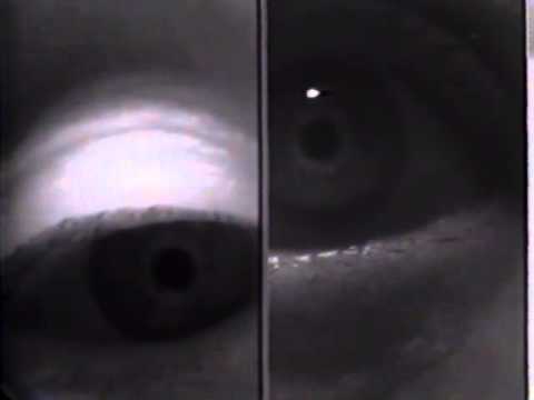 Video: MS Eye Twitch: Årsaker, Behandling Og Utsikter