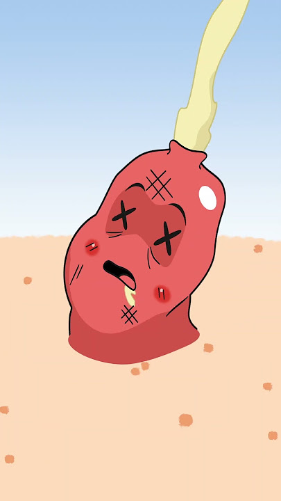 #Shorts | Lawak Kampus School Daze | When two pimples fall in love Pt.2 |  #lkschooldaze