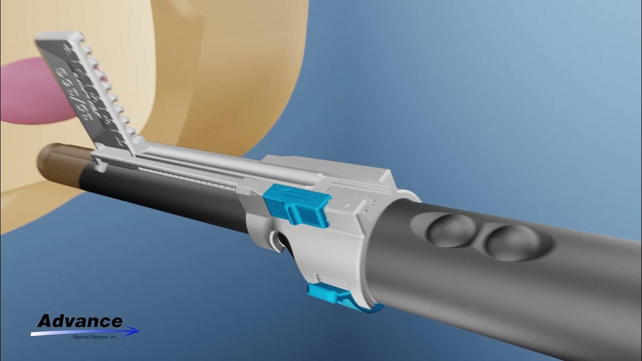 SureFire BK Biplane Freehand Transperineal Needle Guide for the BK
