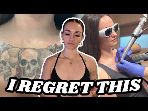 I’m Removing 9 Tattoos… Here’s Why thumbnail