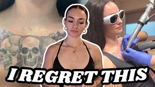 I’m Removing 9 Tattoos… Here’s Why