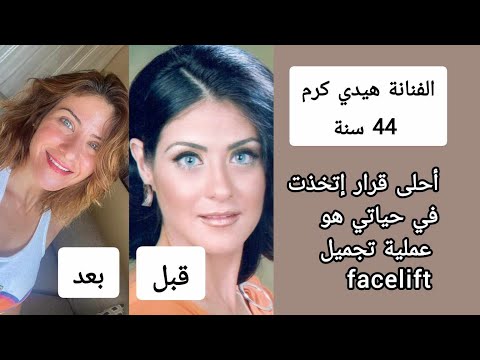 الفنانه المصرية هيدي كرم 44سنة تحكي عن نجاح عملية شد الوجه التي عملتها مأخرا 