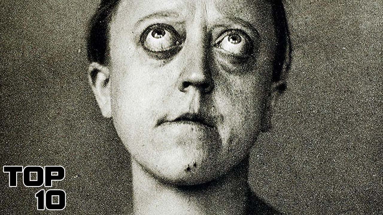 Top 10 Medical Photos Doctors Don't Want You To See YouTube