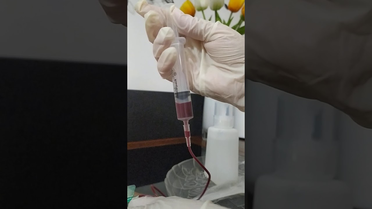AUTO HEMOTERAPIA (passo a passo) YouTube