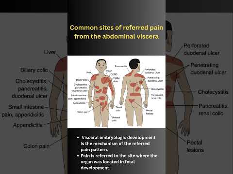 Common Sites Of Referred Pain From The Abdominal Viscera Quick Visual Revision For Doctors