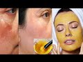 हल्दी में बस एक चीज मिला कर लगा लो ।skinwhiting , glowing face, skin tightening