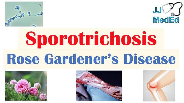 Sporotrichosis (Rose Gardeners Disease): Causes, R...