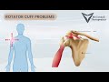 Shoulder Pain explainer video