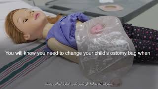 Ostomy Care (Arabic Version)