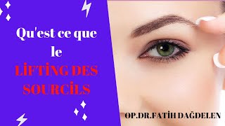 Qu'est ce que le lifting des sourcils