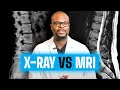 MRI vs X Ray : What’s the difference?