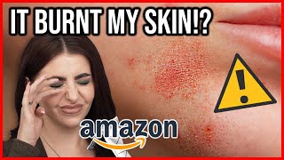 This BURNT My Face!? ⚠️ Testing £35 *AMAZON* Makeup Kit! screenshot 5