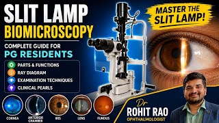 Slit Lamp Examination for First-Year Ophthalmology Residents | Complete Tutorial Dr Rohit Rao 