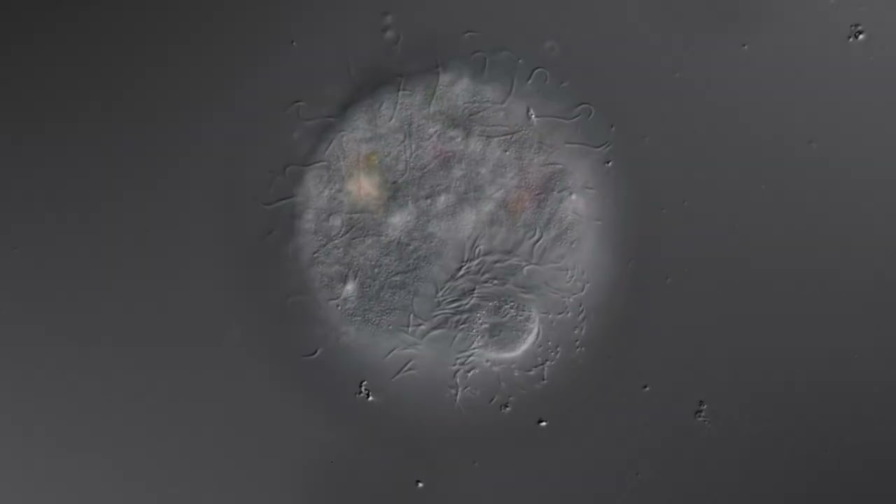 Prorodon - cytostome view