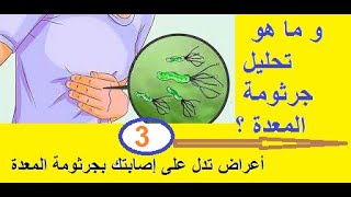 3 أعراض تدل على إصابتك بجرثومة المعدة.. و ما هو تحليل جرثومة المعدة ؟