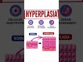 Hyperplasia Explained in 30 Seconds