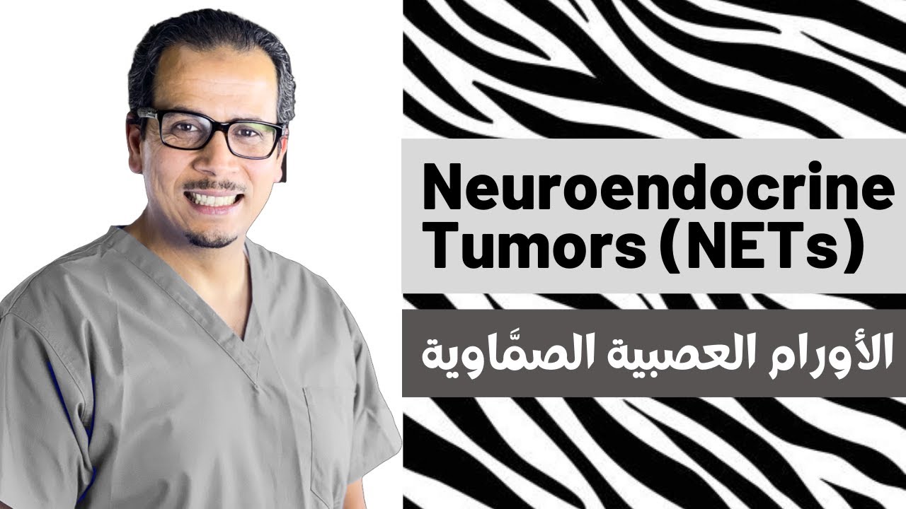 الأورام الصمّية العصبية | Neuroendocrine tumors (NETs) | الدكتور أسامة حامد