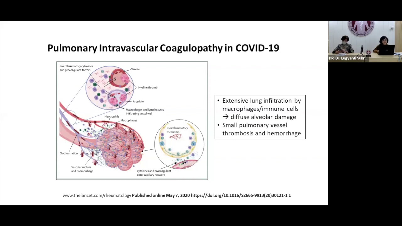 Home Perhimpunan Dokter Spesialis Kardiovaskuler Indonesia Perki