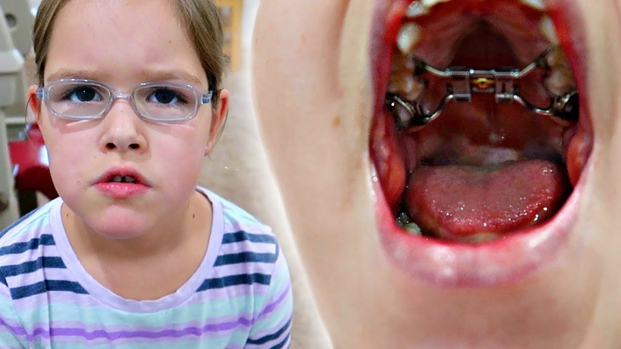 😷The Orthodontist Did It! YouTube
