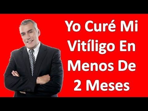 3 Fáciles Remedios Para El Vitiligo Tratamiento Natural - Vitiligo La Cura Permanente En 2 Meses