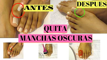 ¿Qué exfoliante es mejor para las manchas oscuras?