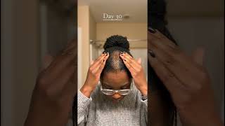 Unbelievable this hair oil is the truth Disclaimer Individual Results May Vary #hairgrowth #hairoil