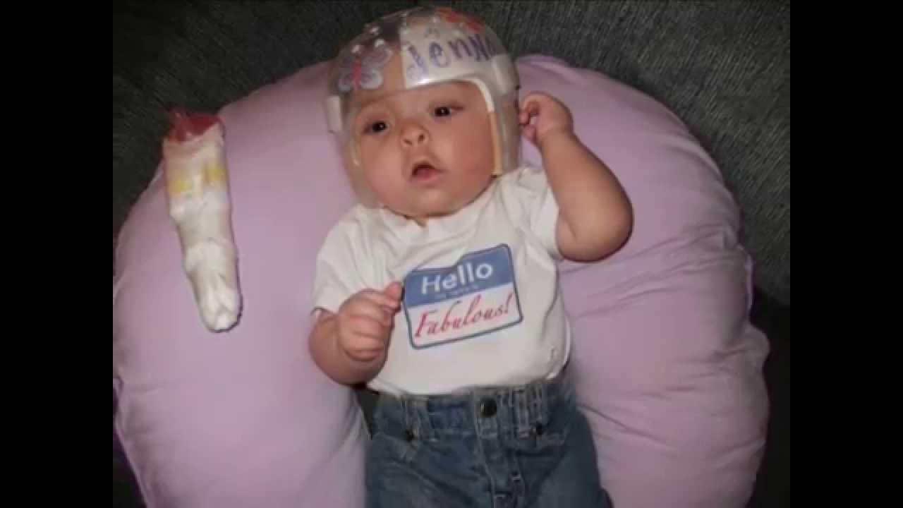 Faces Of Chromosome 18