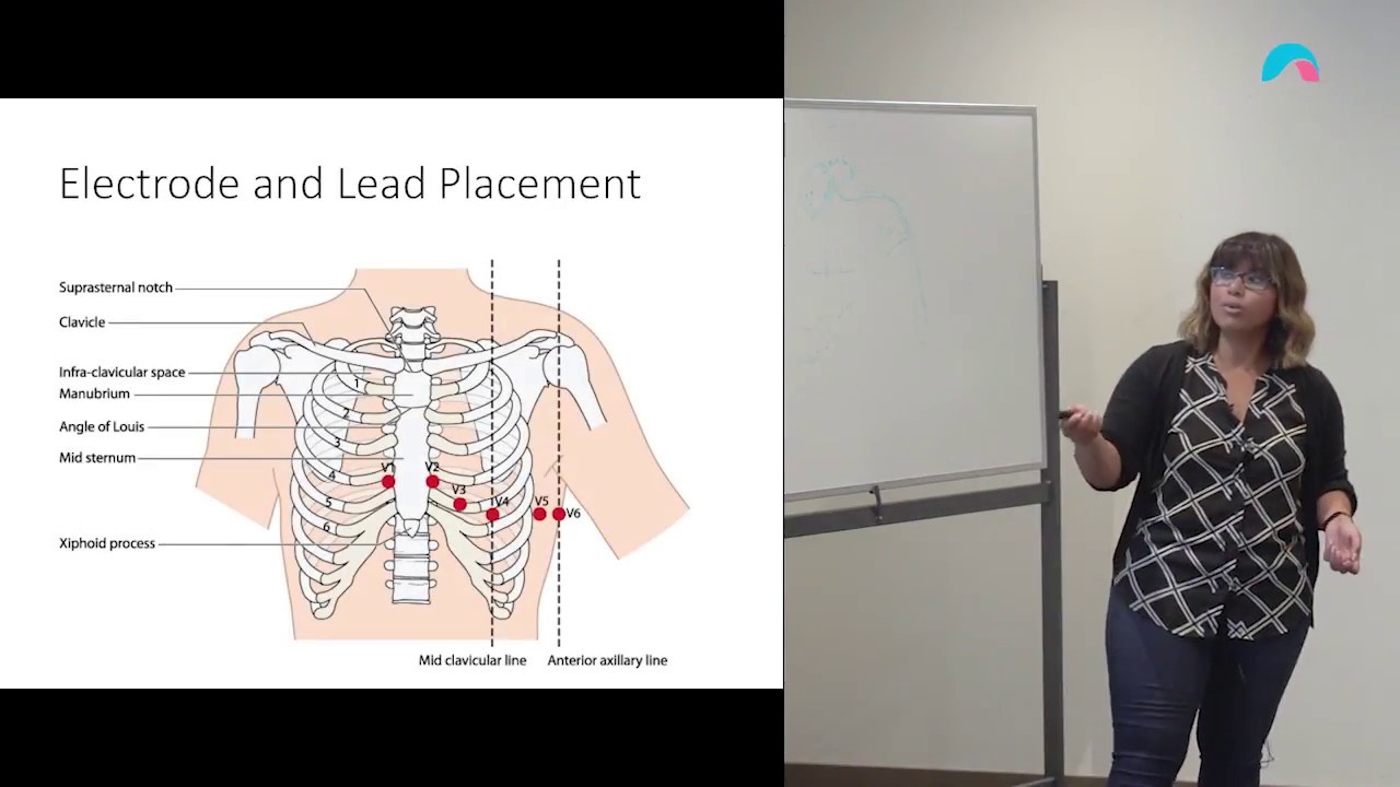 Ekg Lead Placement Chart