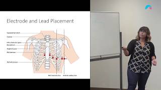 12 Lead ECG Placement - Clavicular Method v Angle of Louis | Ausmed