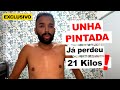 Unha Pintada perde 21 Kg por problemas de saúde