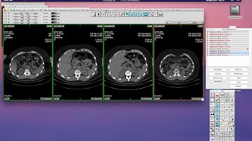 Multiframe SC DICOM part 1