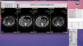 Multiframe SC DICOM part 1